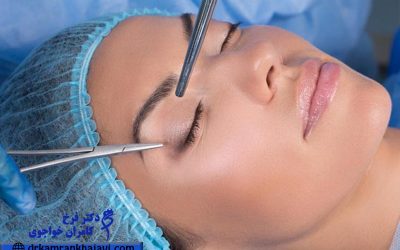 جراحة تجميل الجفون