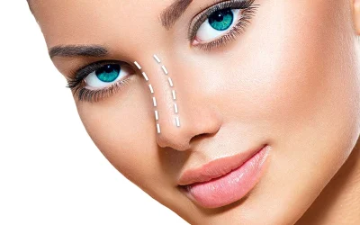 أفضل جراح أنف